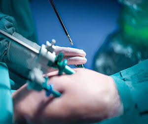 ASU | For the first time in Egypt…Ain Shams University prepares to  implement robotic surgery in its university hospitals