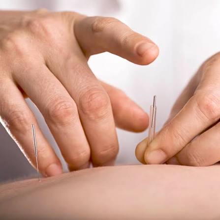 Acupuncture: Effectiveness and Safety | NCCIH