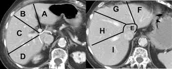 These short objective type questions with answers are very important for competitive exams. Liver Anatomy Quiz Test Your Knowledge Springerlink