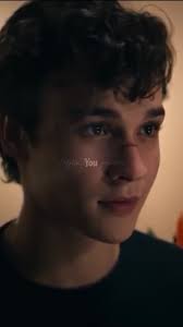 The Story Behind Marcus Lopez's Scar Revealed