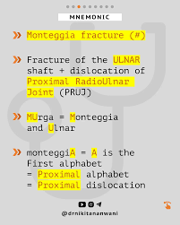 Image result for Galeazzi Sign