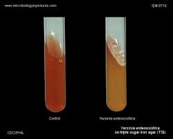 Image result for yersinia fotos