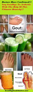 Page 2427 Site Semestamp3 Free Music Download Lagu Mp3 Gratis Gout Remedies Natural Health Remedies Natural Healing Remedies