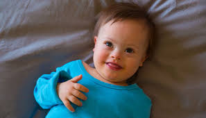 Breastfeeding Your Infant With Down Syndrome