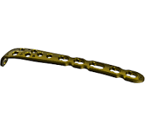 Olecranon Locking Plate - Deva Tibbi