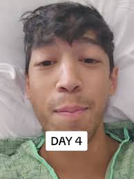 Excited to Go Home After Kidney Transplant Recovery