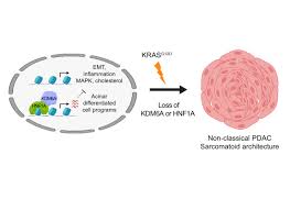 Chemotherapy drugs are usually administered in cycles, with alternating periods of treatment and recovery. The Embo Journal On Twitter Insights Into Transcriptional Contribution To Pancreatic Cancer Development Mkalisz1805 1jorgeferrer Et Al Find Epithelial Program Driven By Hnf1a And Kdm6a Suppressing Kras G12d Driven Tumorigenesis Https T Co
