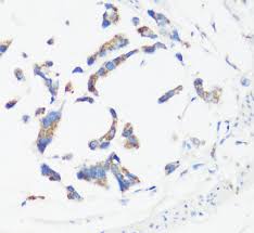 Purification at different ph values using. Cancer Markers Search Results Mybiosource
