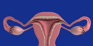 Tanda kanker serviks lainnya dapat dilihat dari kondisi organ wanita yang mengalami sakit pada pelvis, mengalami pendarahan apabila sudah dilakukan pemeriksaan pelvis, mengalami pendarahan. Gejala Kanker Rahim Stadium Awal Yang Mudah Dikenali Ketahui Cara Mengobatinya Merdeka Com