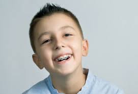 Can Braces Fix Gaps in Teeth?