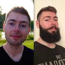If you are an obese person, your testosterone levels will be low. What Is A Way To Grow Facial Hair Fast Quora