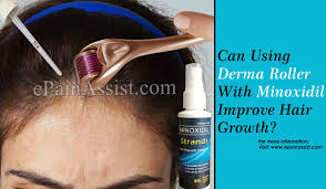 Hair loss takes place slowly over time, and hair growth also takes time. Can Using Derma Roller With Minoxidil Improve Hair Growth