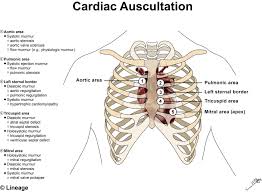 heart murmurs cardiovascular medbullets step 1