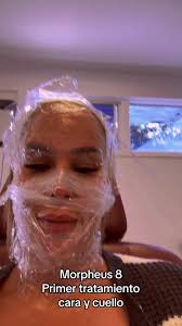 Primer Tratamiento Morpheus 8 #morpheus8 #labellezacuesta #antesydespues  #wunderbarmedspa