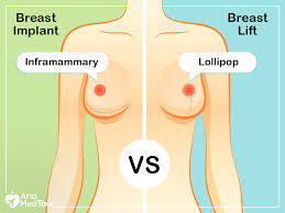 We did not find results for: Breast Implants Vs Breast Lift The Differences And Similarities