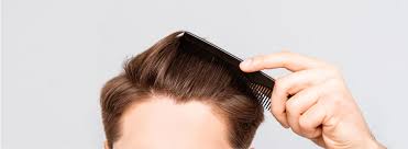 Hair Treatment-Drug/Topical Therapies