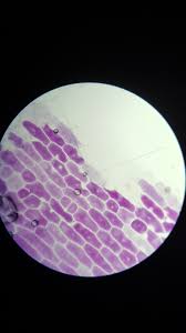 Turgid plant cell under microscope. Onion Cells In A Sucrose Solution A Level Revision