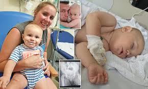 Barney walk around block friends pbs miller cathey wiki wikia studio painting scenery down catheymiller barber. Parents Who Dismissed Baby S Symptoms As Teething Are Shocked To Find It Was A Deadly Infection Daily Mail Online