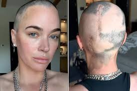 🎗️💪 Teddi Mellencamp's inspiring journey through cancer is a testament to  resilience and hope! After battling stage 4 melanoma that spread to her  brain and lungs, she's shared her scars, tears, and