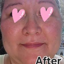 TOP 10 BEST Dermatologists in Prescott, AZ