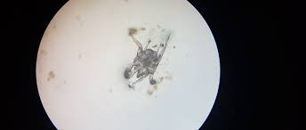 Image result for what do otodectes cynotis look like in dog fur