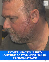 This father was brutally assaulted by a stranger outside a Boston hospital.  John Baglio says he and his wife were visiting their son, who was being  treated for a critical heart condition,