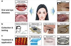 What are the symptoms that occur before death with lung cancer stage 4? Micro Nanodevices For Assessment And Treatment In Stomatology And Ophthalmology Microsystems Nanoengineering