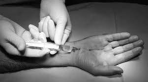 Image result for Hand Injection
