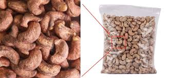 Does Cashew Nuts Cause Acne Pimples And Why