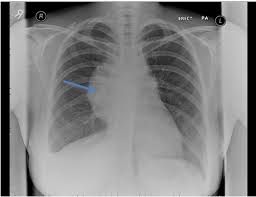 نتیجه جستجوی لغت [widened] در گوگل