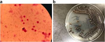 Image result for CSF Culture