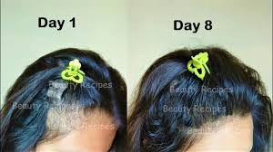 Aloe vera gel also helps reduce sebum, or oil, on the scalp. She Rubs Aloevera On Her Hair Turned Thin Hair To Thick Hair In 1 Week Onion For Hair Thick Hair Styles Hair Fall Remedy