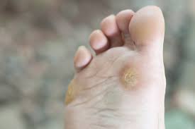 Pin On Health
