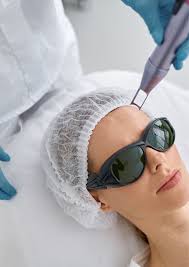 LÁSER Q-SWITCHED (By clearlift cara) — RACHEL KEYS