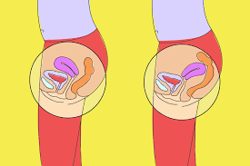 Utero Retrovertido O Que E E A Relacao Com A Gravidez Bebe Com Br