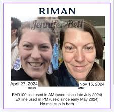 Benefits of not bathing daily for skin