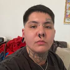 Does Botox work for stroke survivors?