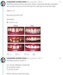Pemilihan ubat sakit gigi di farmasi bergantung kepada kesesuaian individu seperti sejarah alahan ubat, umur, kesesuaian dengan penggunaan ubat kronik lain dan sebagainya. Ubat Gigi Expired Lamaran L