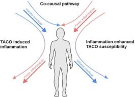 Image result for Transfusion Associated Circulatory Overload