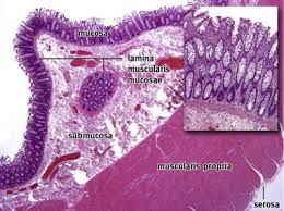 The Pathology Of Colorectal Polyps And Cancers Including Biopsy Surgery Oxford International Edition