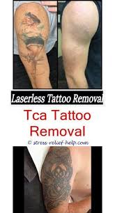Temporary Tattoos Laser Tattoo Removal London How To Have A Tattoo Removed Tattoo Removal Cre Laser Tattoo Removal Healing Tattoo Removal Cost Tattoo Removal
