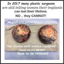 Maybe you would like to learn more about one of these? Breast Implants Do Not Last A Lifetime Breast Implant Failure Illness