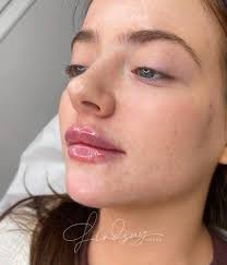 Let me explain why I don't do standard treatments anymore 🫶🏽