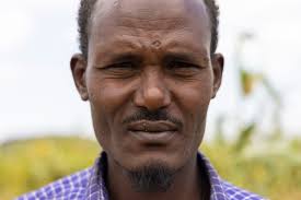 In the Somali region of Ethiopia, surgery brings relief to farmer with  trachoma