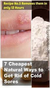Pin On Home Remedies