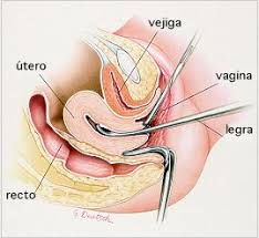 Thepesiporanssemb S Blog