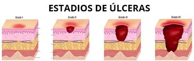 Clasificación de las Lesiones