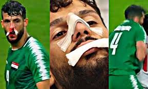 شاهد عبر isn رأسية سعد ناطق التي منحت التقدم للشرطة في مرمى الاهلي عند الدقيقة 14. Ø§Ù„Ù…Ù†ØªØ®Ø¨ Ø§Ù„Ø¹Ø±Ø§Ù‚ÙŠ ÙŠØ®Ø³Ø± Ø¬Ù‡ÙˆØ¯ Ø³Ø¹Ø¯ Ù†Ø§Ø·Ù‚ ÙÙŠ Ù…Ø¨Ø§Ø±Ø§Ø© Ø§Ù„ÙŠÙ…Ù† Ø¨Ø¹Ø¯ Ø§ØµØ§Ø¨ØªÙ‡ Ø§Ù„Ø®Ø·ÙŠØ±Ø© ÙÙŠ Ø§Ù„Ø¬ÙˆÙ„Ø© Ø§Ù„Ø«Ø§Ù†ÙŠØ© Ø¨Ù€ Ø®Ù„ÙŠØ¬ÙŠ 24 Ù‡Ø§Ø´ØªØ§Ù‚Ø§Øª ØµØ­ÙŠÙØ© Ø¥Ù„ÙƒØªØ±ÙˆÙ†ÙŠØ© Ø´Ø§Ù…Ù„Ø© Ù…Ø³ØªÙ‚Ù„Ø©