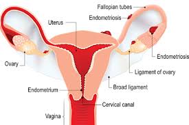 The uterus has three layers, which together form the uterine wall. Endometriosis Honorhealth