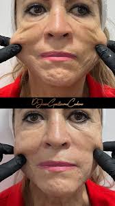 Dr. Juan Guillermo Cadena Mora